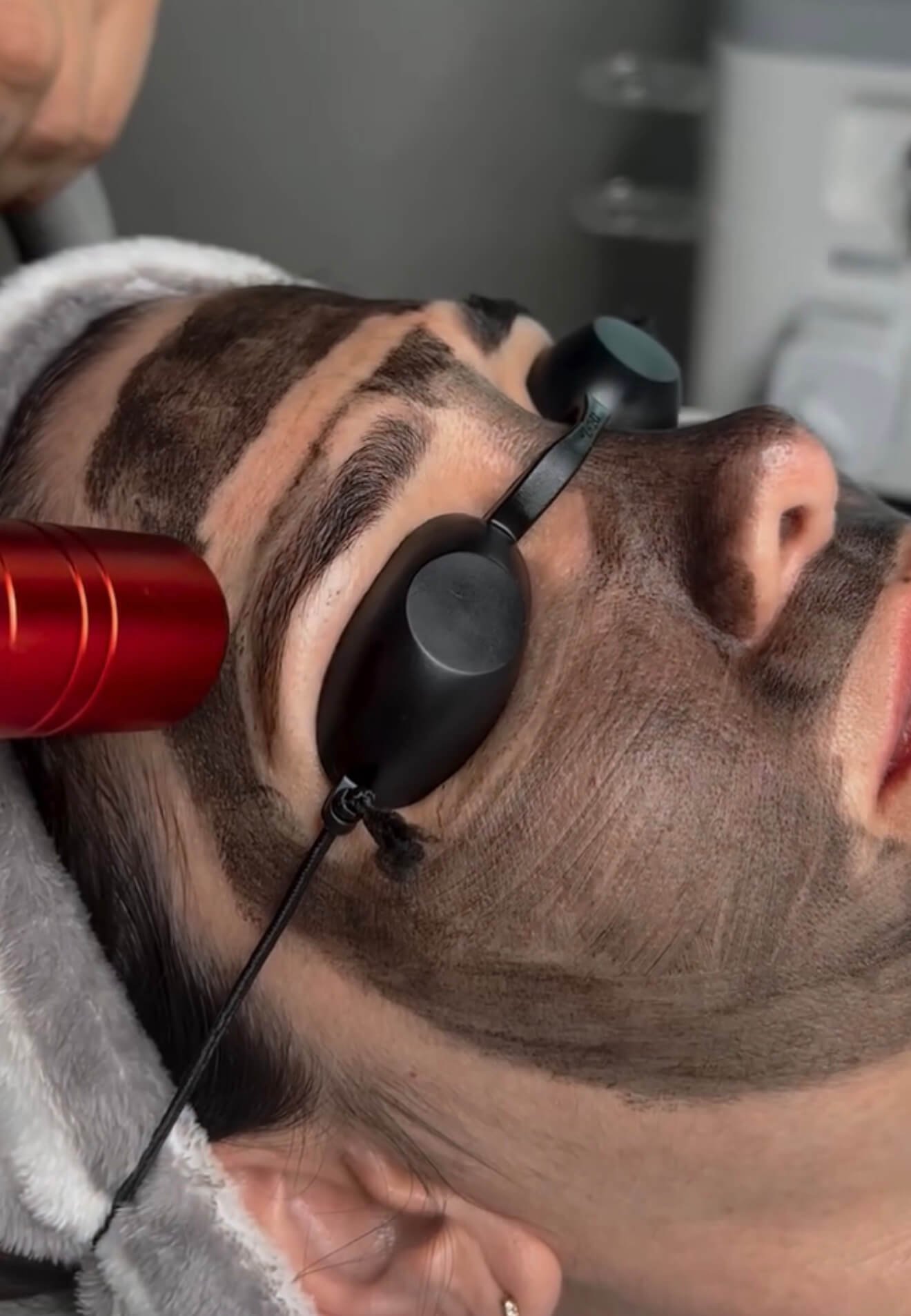 Hollywood Peel
